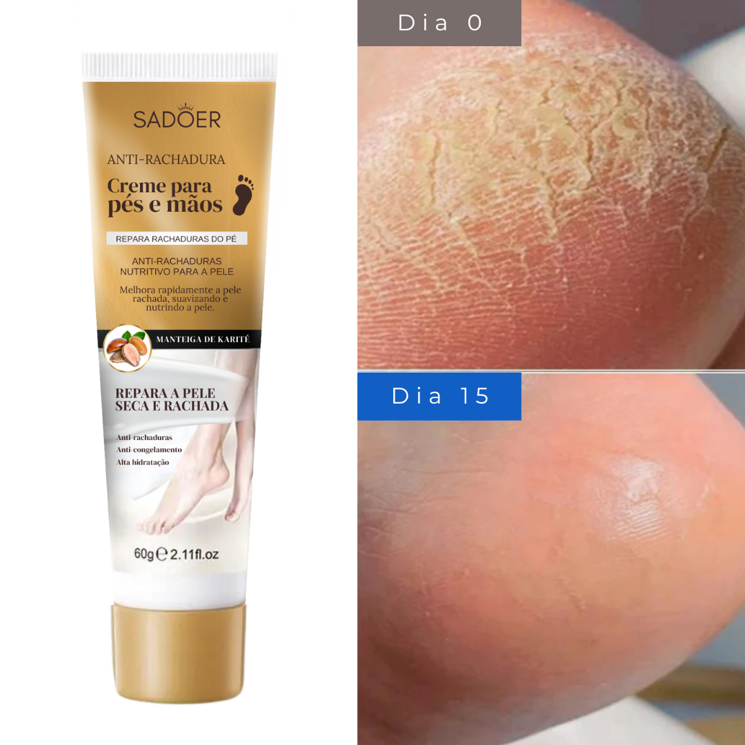 Creme Anti-rachaduras para Mãos e Pés 60g