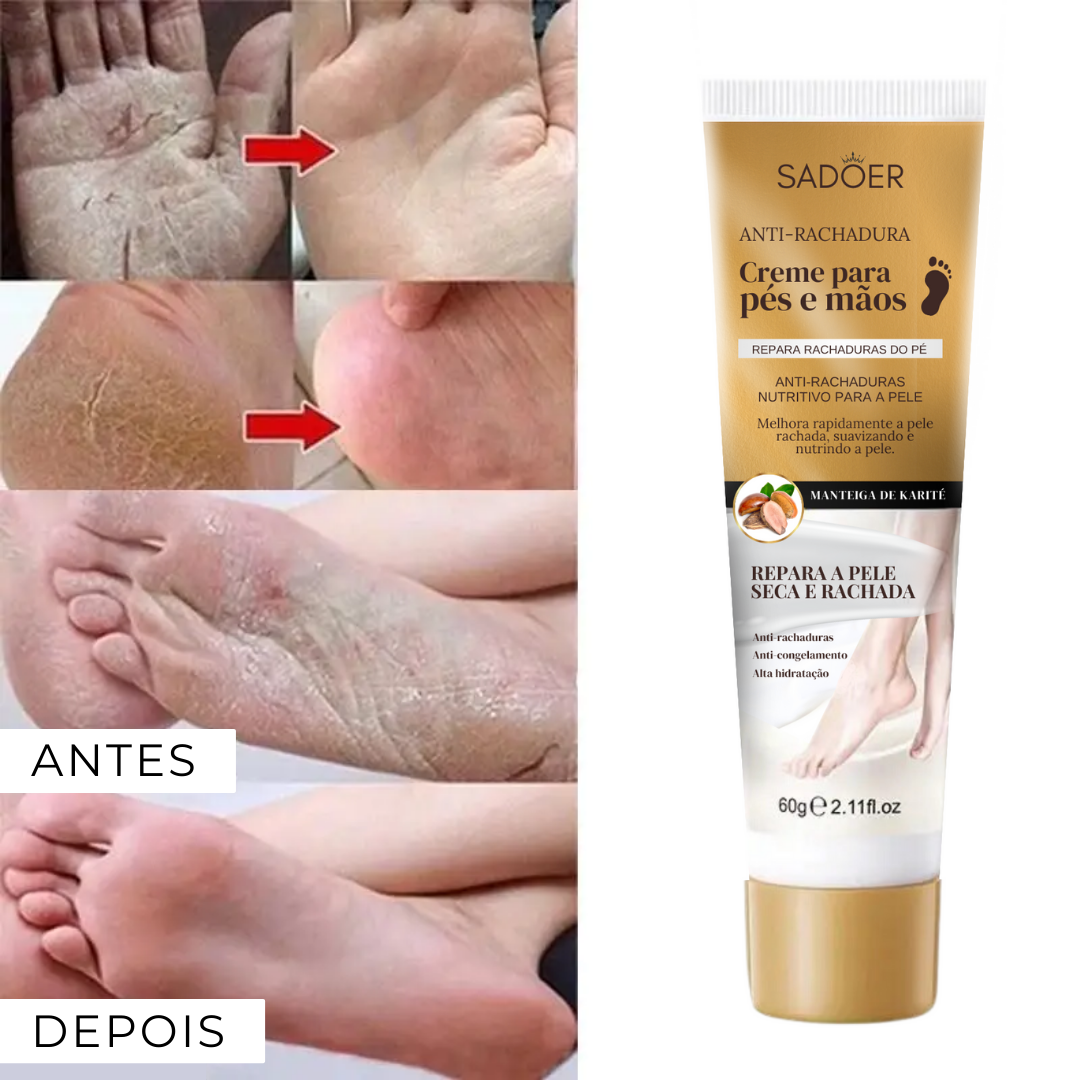 Creme Anti-rachaduras para Mãos e Pés 60g